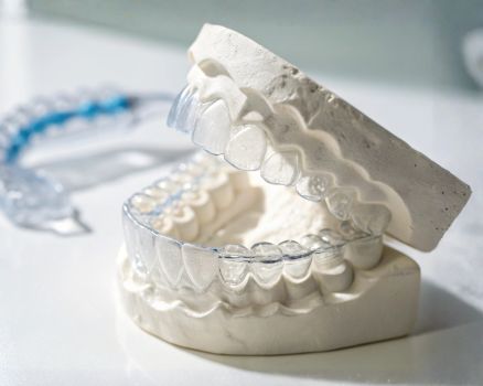 Custom Clear Aligners Mysore